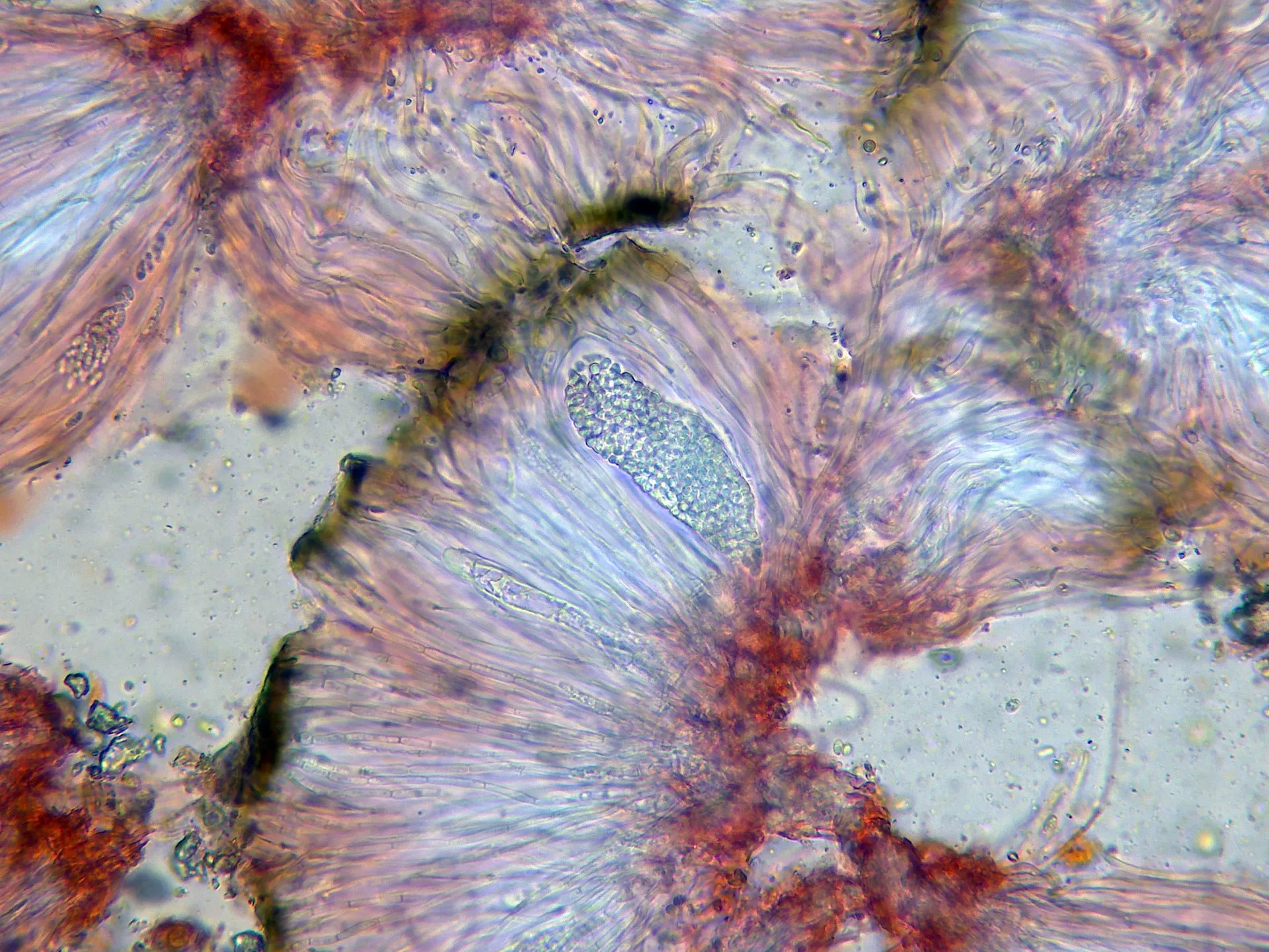 Microscopía de Sarcogyne regularis - 10 - Himenio x 400-004